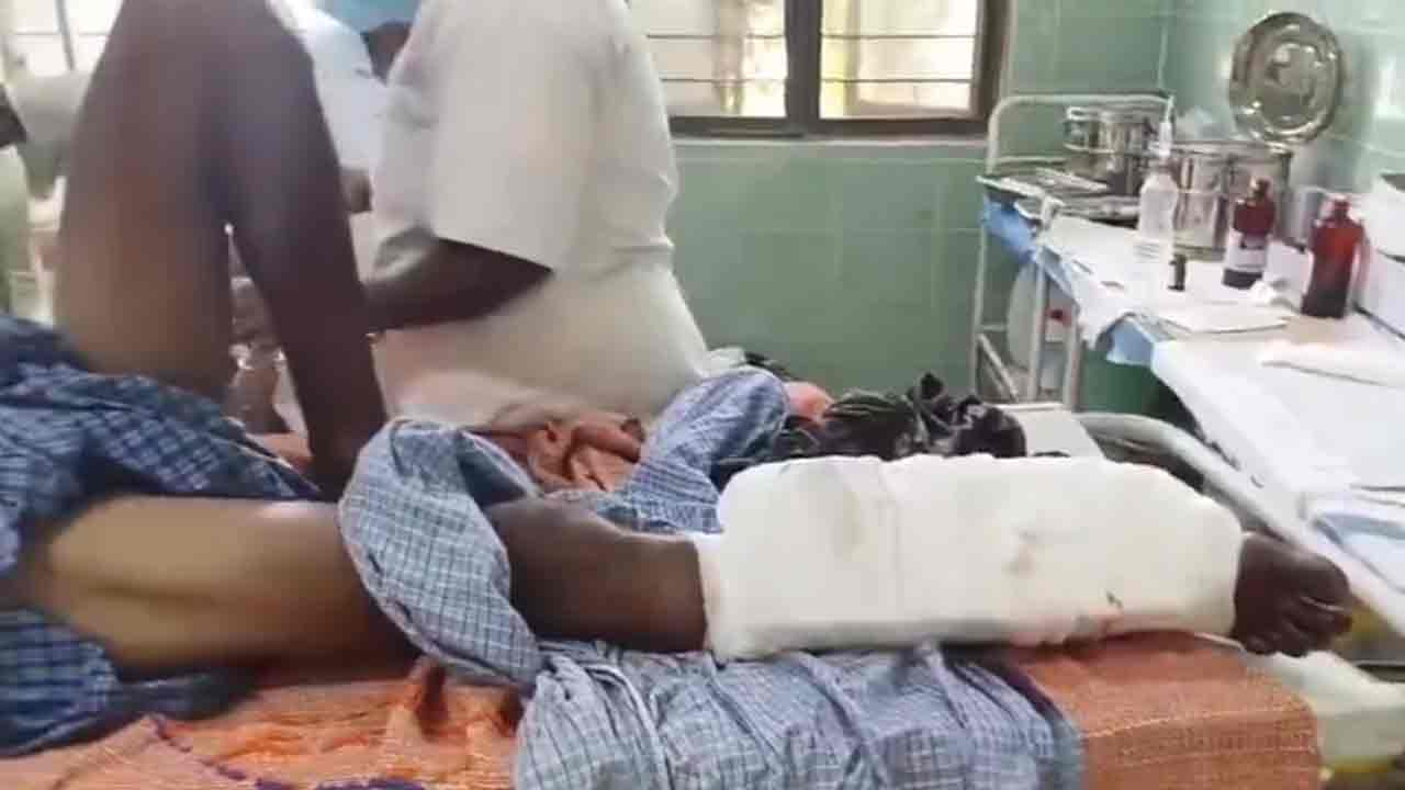 Mulugu | పొలంలో పేలిన నాటు బాంబు.. నుజ్జునుజ్జైన రైతు కాలు