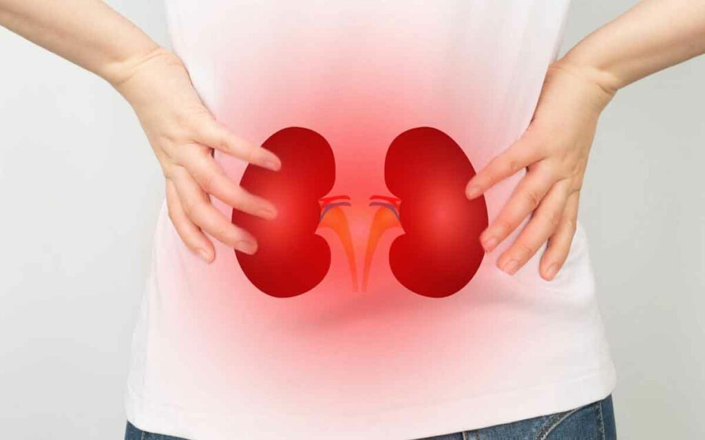 Kidneys