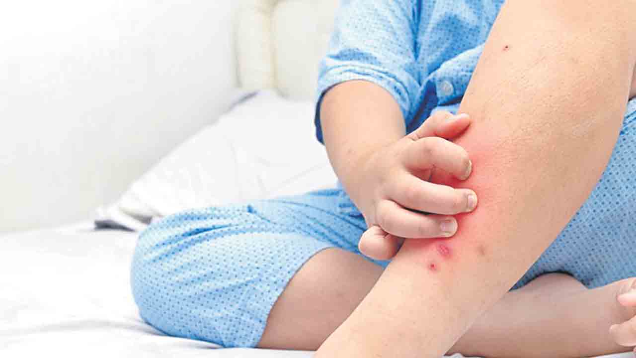 జ్వరంతో దద్దుర్లు వస్తే ప్రమాదమా?