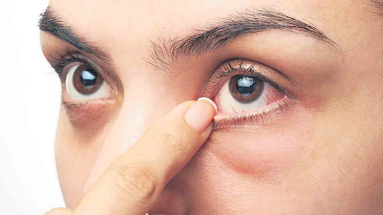 కంటిని కాపాడుకుందాం