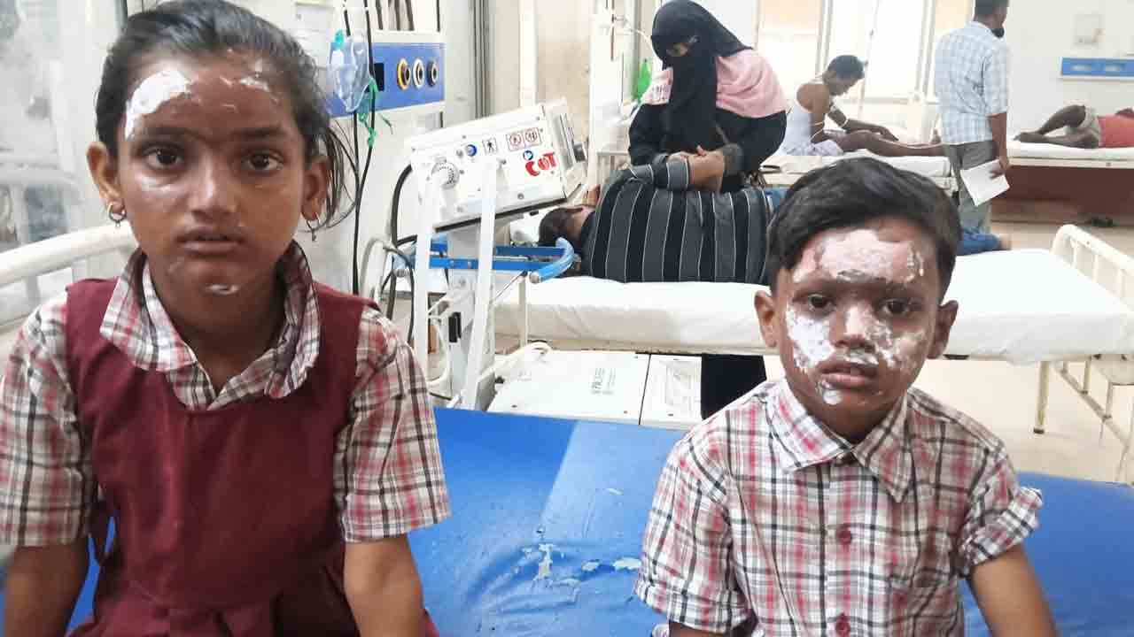 పటాకులు పేల్చడంతో విద్యార్థులకు గాయాలు