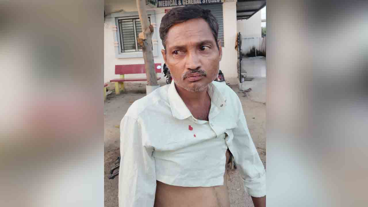 Monkeys attack | కోతుల మూకుమ్మడి దాడి..యువ రైతుకు తీవ్ర గాయాలు