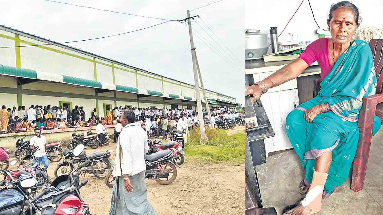 కాళ్లు విరిగె!.. సోయా కొనుగోళ్ల టోకెన్ల జారీలో తోపులాట