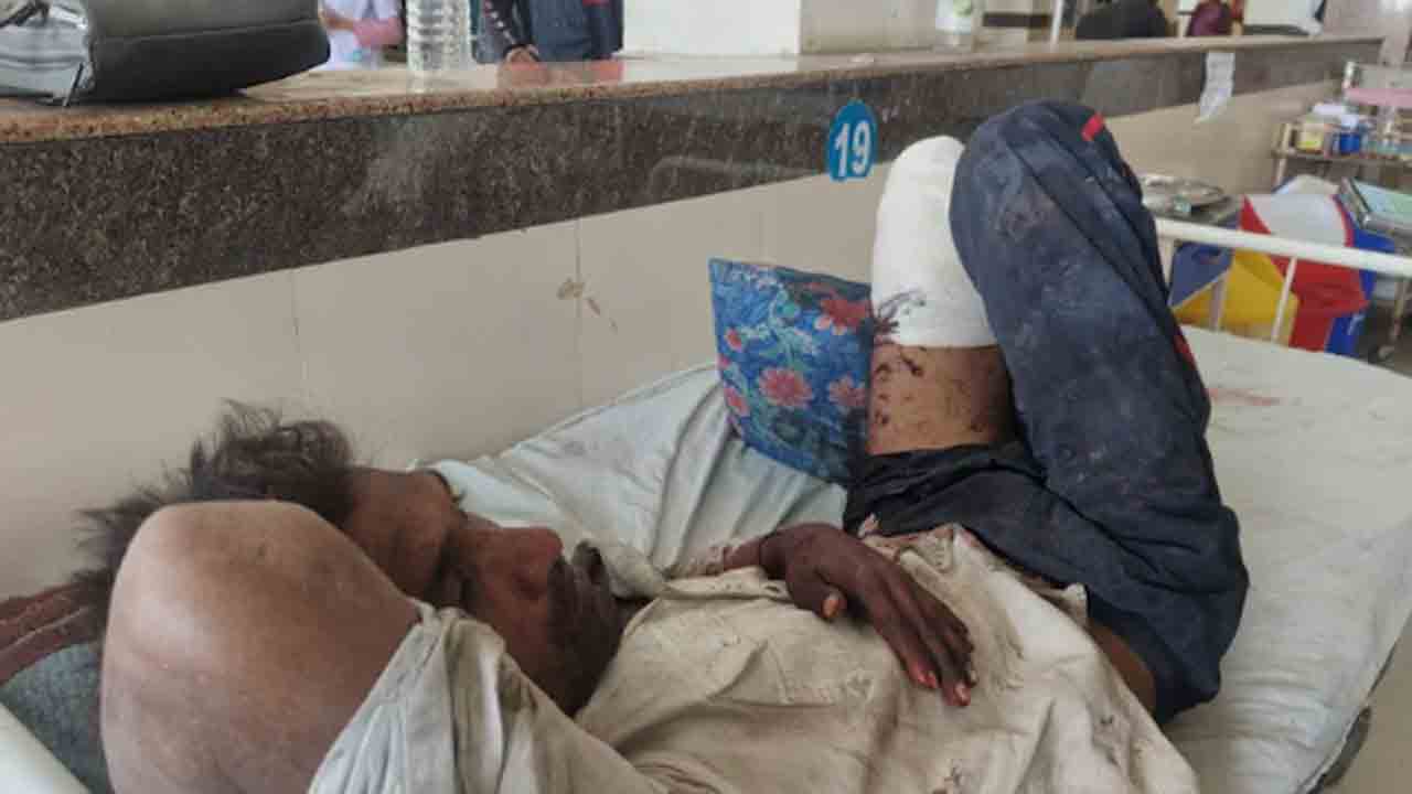 Man Robbed, Loses Leg | రైల్వే పోలీసుల నిర్లక్ష్యం.. కాలు కోల్పోయిన వ్యక్తి