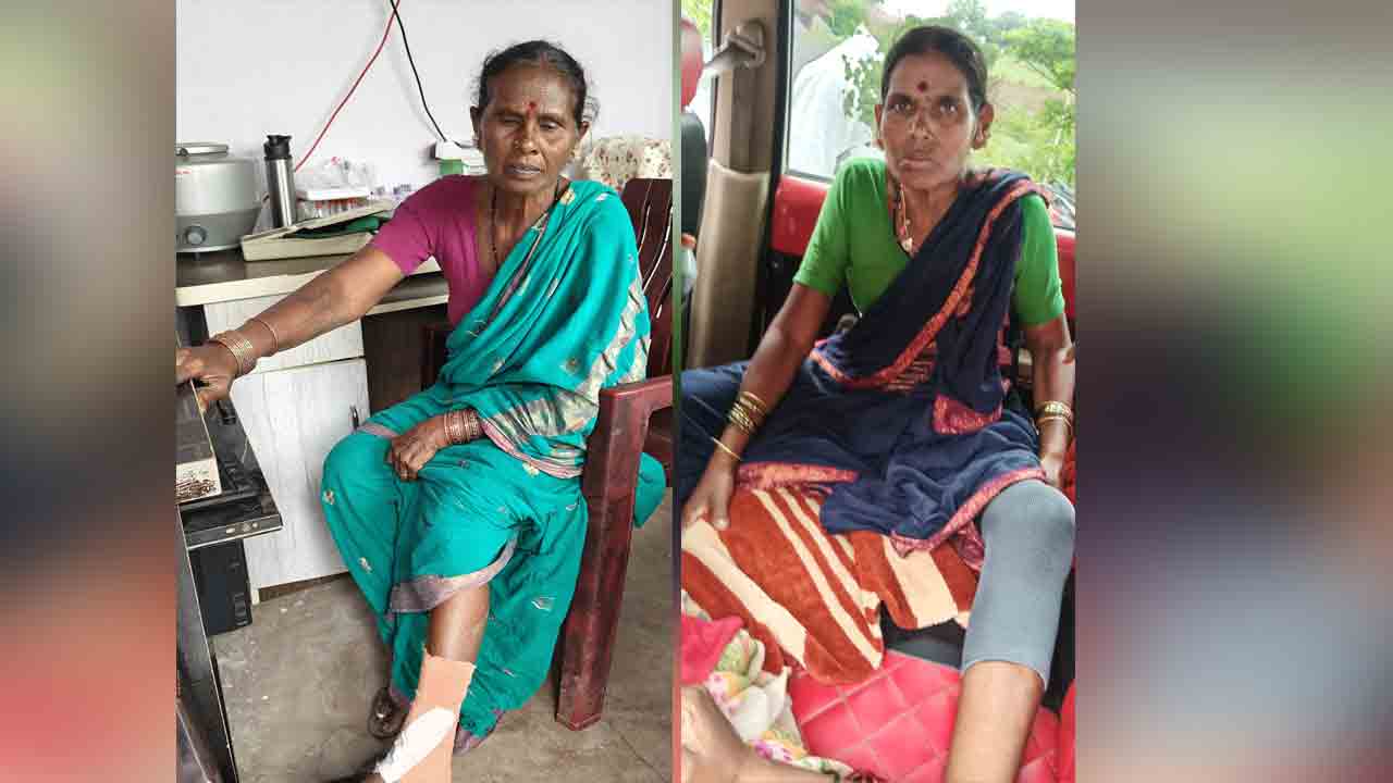 Soya Tokens | సోయా టోకెన్ల జారీలో తోపులాట.. ఇద్దరు మహిళా రైతులకు తీవ్ర గాయాలు