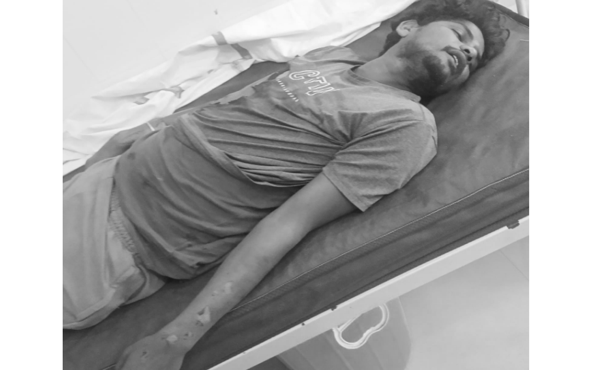 Karepally : విద్యుత్ షాక్‌తో యువకుడు మృతి