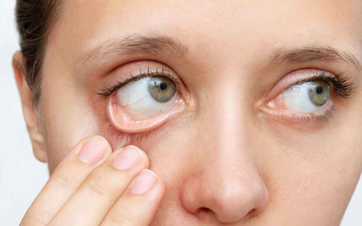 Anemia | ర‌క్తం త‌క్కువ‌గా ఉందా..? అయితే ఈ చిట్కాల‌ను పాటించండి.. ఎంతో ఫ‌లితం ఉంటుంది..