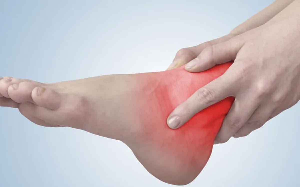 Ankle Pains | కాలి మడమల నొప్పులు తీవ్ర ఇబ్బందులకు గురి చేస్తున్నాయా..? అయితే ఈ చిట్కాలను పాటించండి..!