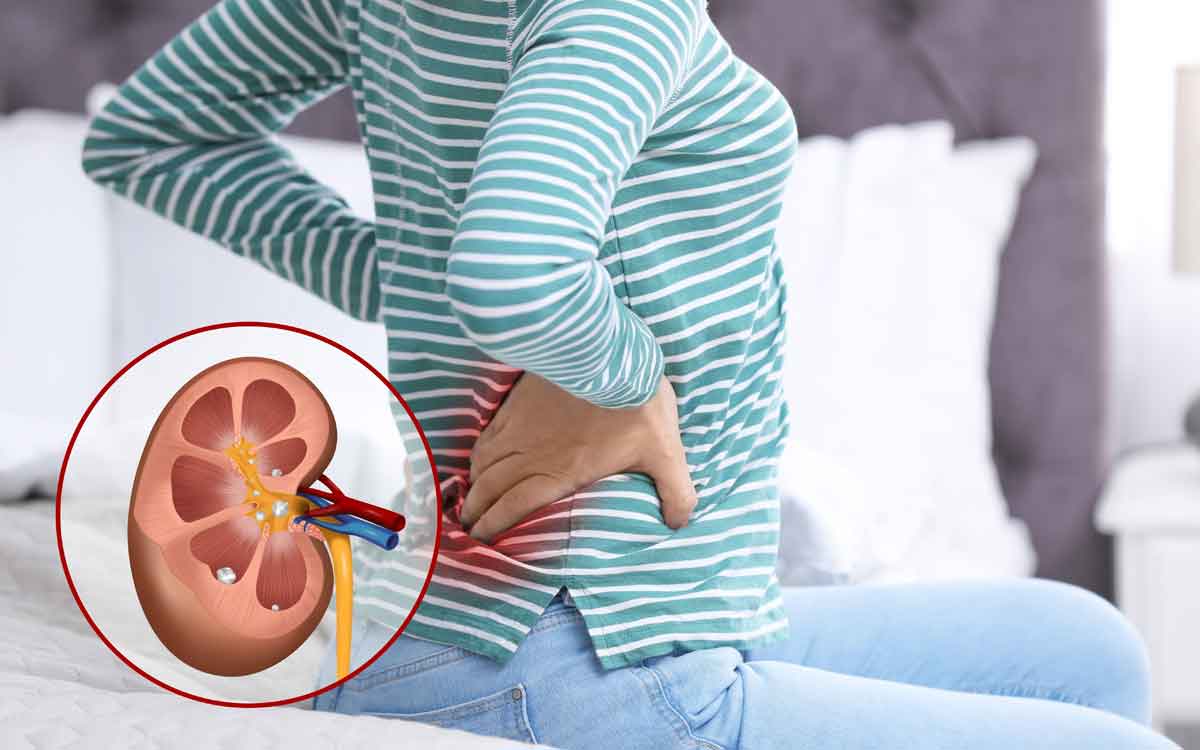 Kidney Stones Symptoms | కిడ్నీ స్టోన్లు ఏర్ప‌డే స‌మ‌యంలోనే వాటిని ఇలా గుర్తించ‌వ‌చ్చు.. మ‌న శ‌రీరం తెలియ‌జేసే ల‌క్ష‌ణాలు ఇవే..!