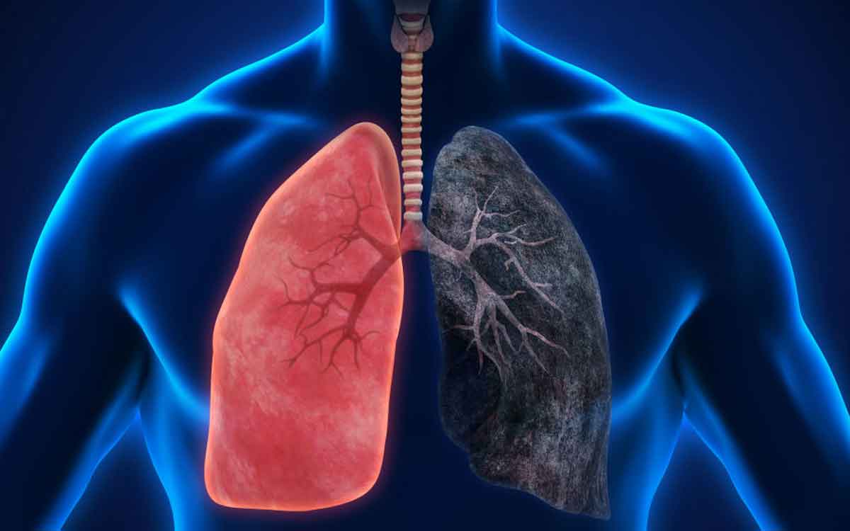 Foods For Lungs Health | ఈ ఆహారాల‌ను రోజూ తీసుకుంటే మీ ఊపిరితిత్తులు ఎల్ల‌ప్పుడూ ఆరోగ్యంగా ఉంటాయి..!