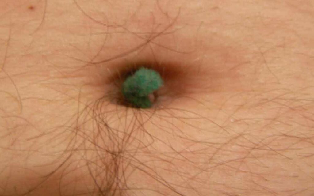 Navel Lint