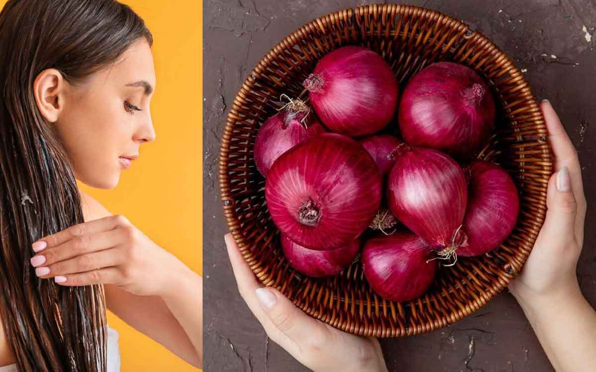 Onion For Hair Growth | ఉల్లిపాయ ర‌సంతో ఈ ఇంటి చిట్కాల‌ను పాటించి చూడండి.. మీ జుట్టు జ‌న్మ‌లో రాల‌దు..!