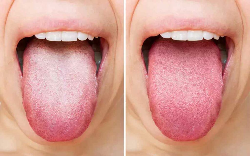 Tongue Color