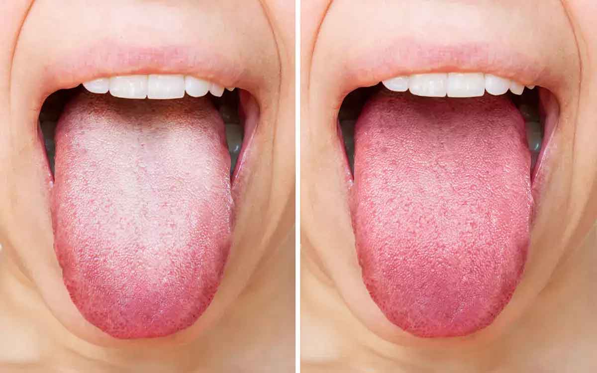 Tongue Color | మీ నాలుక ఏ రంగులో ఉంది..? దాన్ని బ‌ట్టి మీకున్న వ్యాధి ఏమిటో ఇలా సుల‌భంగా గుర్తించండి..!