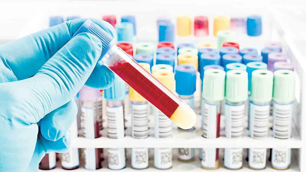 మరణ ముప్పును ముందే పసిగట్టే బ్లడ్‌ టెస్ట్‌