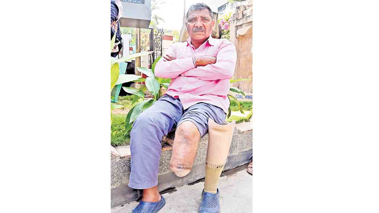 Singareni | కాలు లేకున్నా ఫిట్‌నెస్‌ ఉన్నట్టేనట!..సర్జరీ అయిన వ్యక్తికి డ్యూటీ చేయాలని సర్టిఫికెట్‌ జారీ