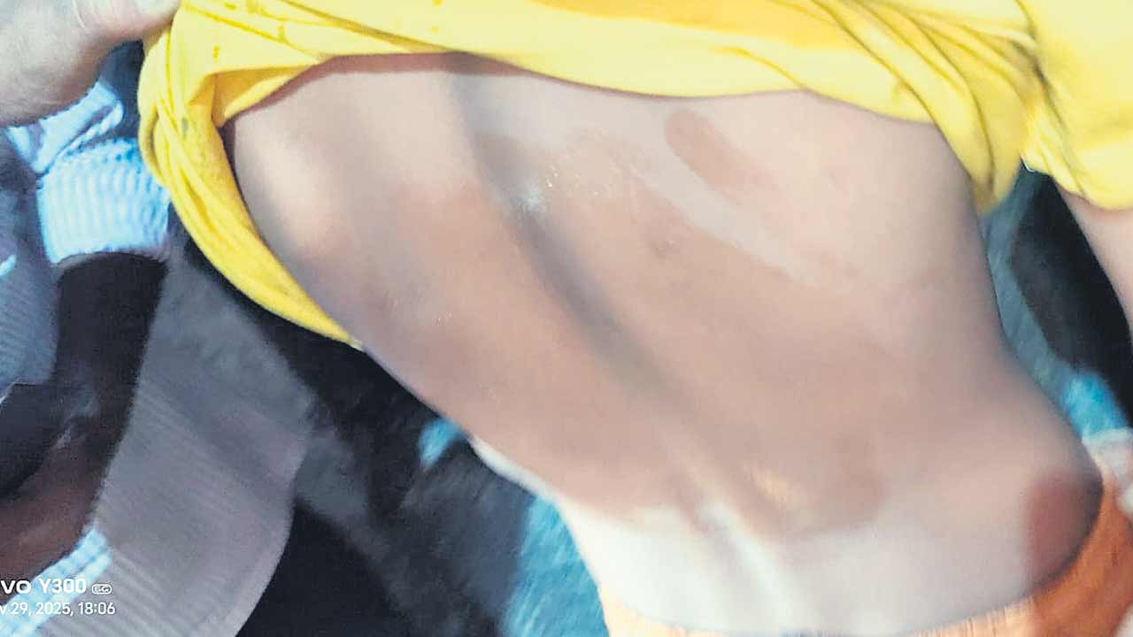 విద్యార్థులను చితకబాదిన టీచర్‌