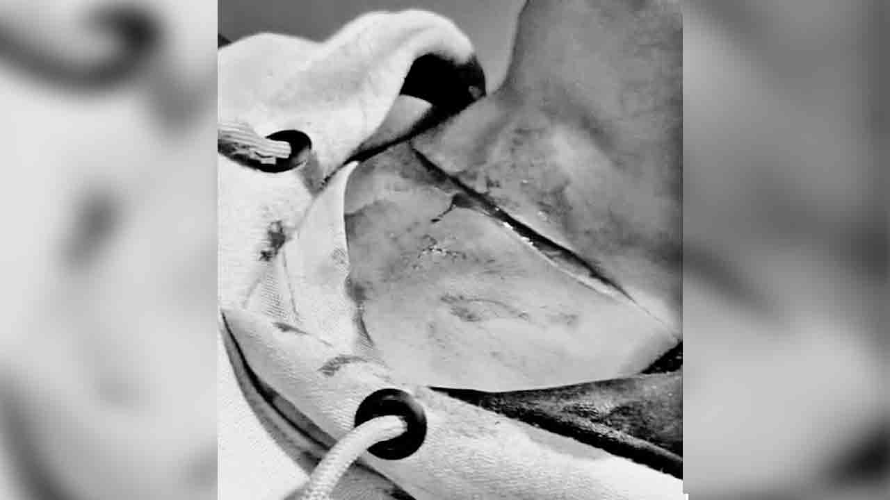 మెడ కోసిన చైనా మాంజా