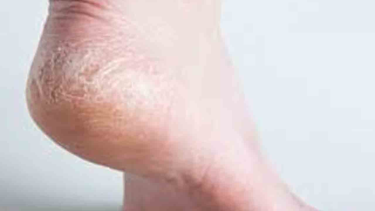 పగుళ్లతో పరేషాన్‌!