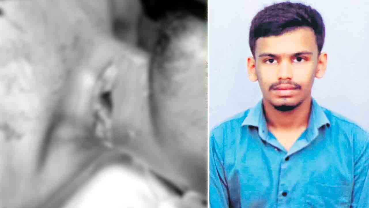 మాంజా మెడకు తగిలి..