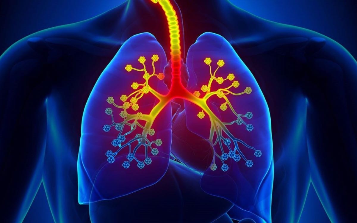 Asthma | ఆస్త‌మా ఉన్న‌వారు ఈ ఆహారాల‌ను రోజూ తీసుకోవాలి.. ఎంతో ఉప‌శ‌మ‌నం పొంద‌వ‌చ్చు..