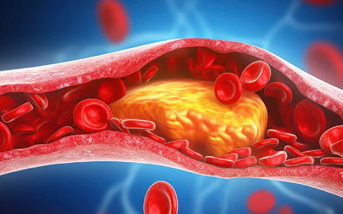 Seeds To Take To Reduce Cholesterol | కొలెస్ట్రాల్ స్థాయిలు అధికంగా ఉన్నాయా..? అయితే ఈ విత్త‌నాల‌ను తీసుకోండి..!