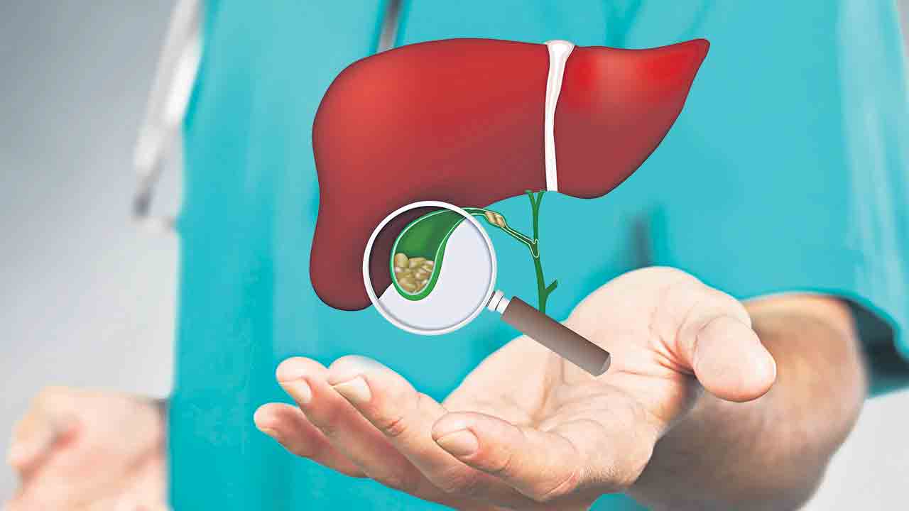 ఆ రాళ్లను తేలిగ్గా తీసుకోకండి.. గాల్‌బ్లాడర్‌ స్టోన్స్‌కు శస్త్రచికిత్సే మందు