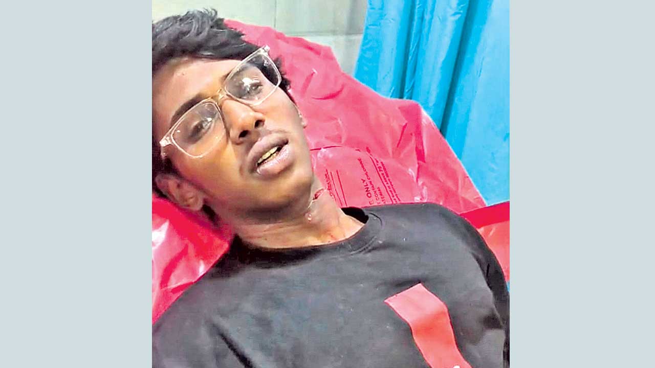 చైనా మాంజా తగిలి తెగిన గొంతు