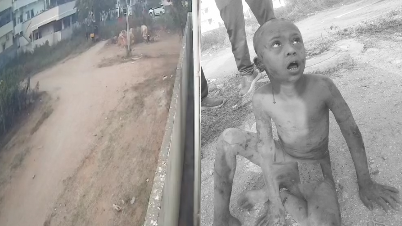 Hayathnagar | హయత్‌నగర్‌లో దారుణం.. మూగ బాలుడిపై వీధి కుక్కల దాడి