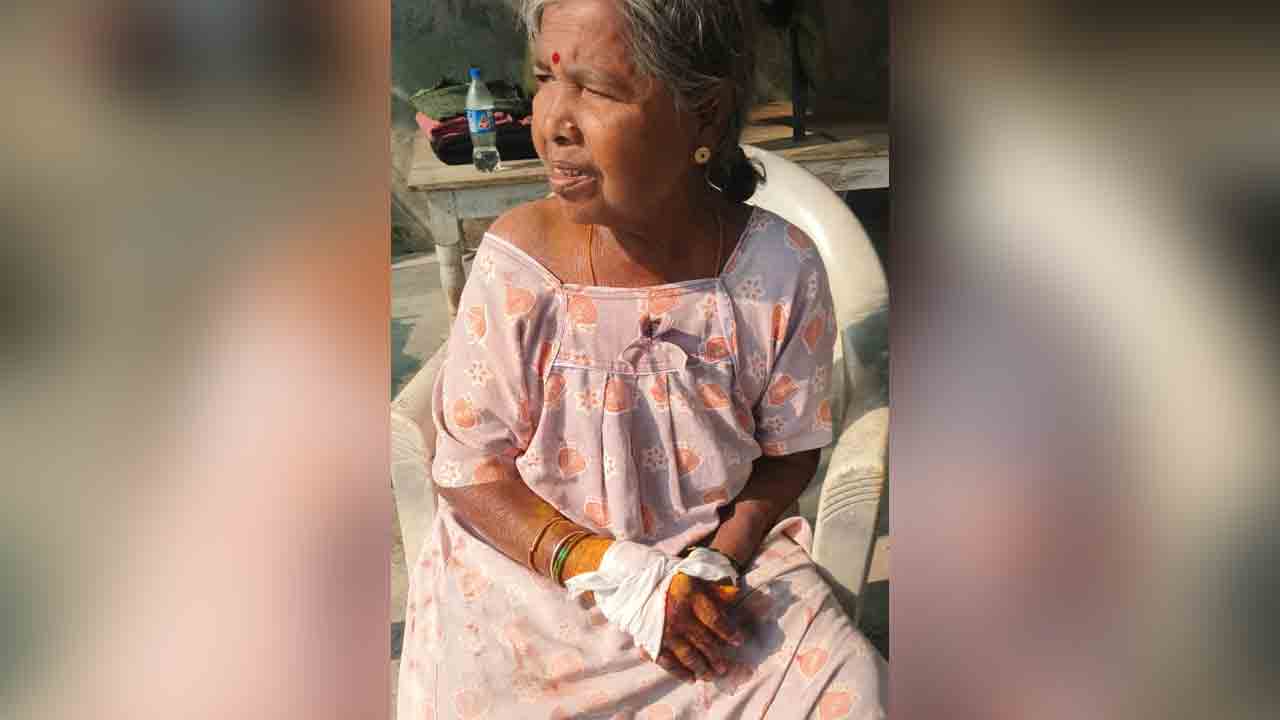 Monkey attack | పెంచికల్‌పేట్‌లో కోతి దాడి.. తీవ్రంగా గాయపడిన మహిళ