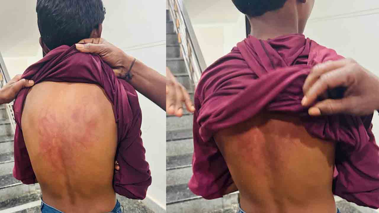 Kompalli | ఏడో తరగతి విద్యార్థిపై దాడి చేయించిన ప్రధానోపాధ్యాయుడు.. !