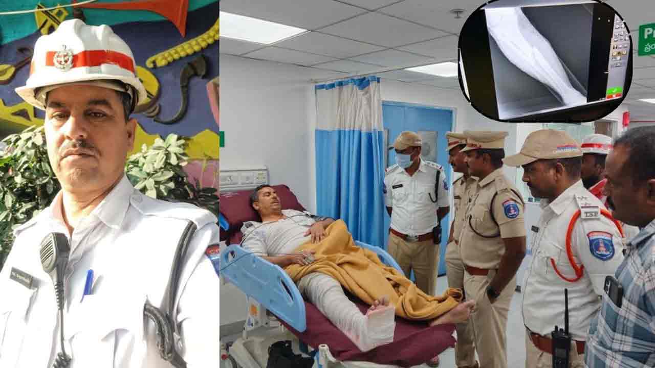 Hyderabad | మాదాపూర్‌లో హోంగార్డును ఢీకొట్టిన కారు.. విరిగిన కాలు