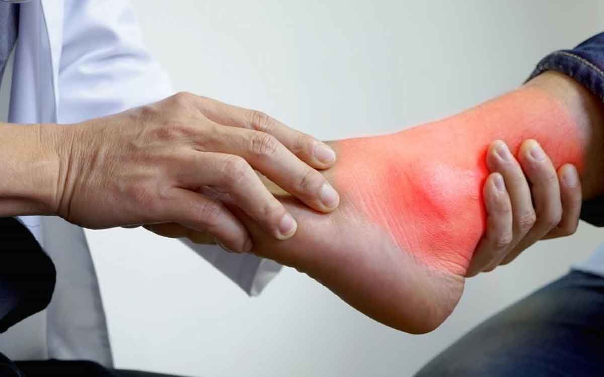 Fruits That Reduce Uric Acid | మీ శ‌రీరంలో యూరిక్ యాసిడ్ స్థాయిలు అధికంగా ఉన్నాయా..? అయితే ఈ పండ్ల‌ను తినండి..!