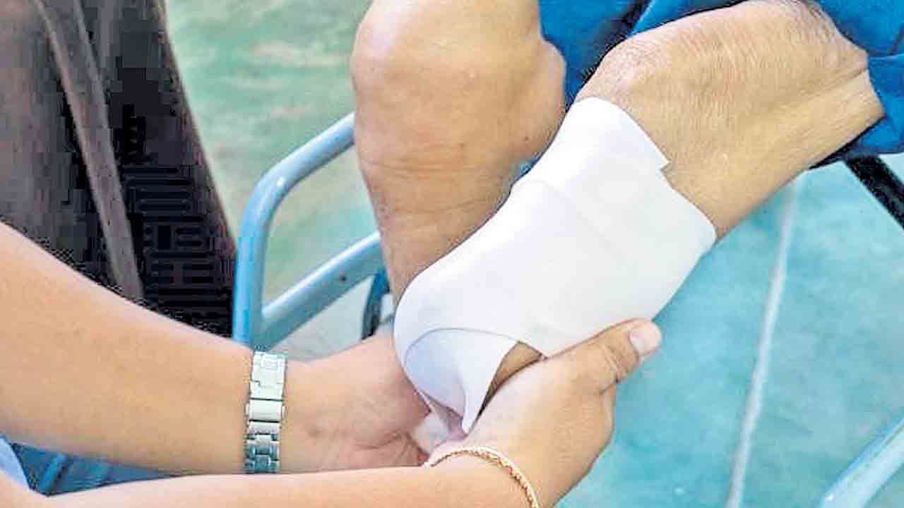 మెడికల్‌ సీటు కోసం పాదాన్ని నరుక్కున్నాడు!