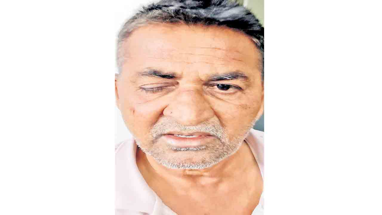 ‘నమస్తే’ విలేకరిపై కాంగ్రెస్‌ గూండాల దాడి