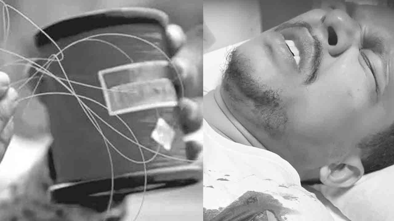 Chinese Manja | చైనా మాంజా తగిలి.. ప్రాణాలతో బయటపడ్డ సాఫ్ట్‌వేర్‌ ఉద్యోగి