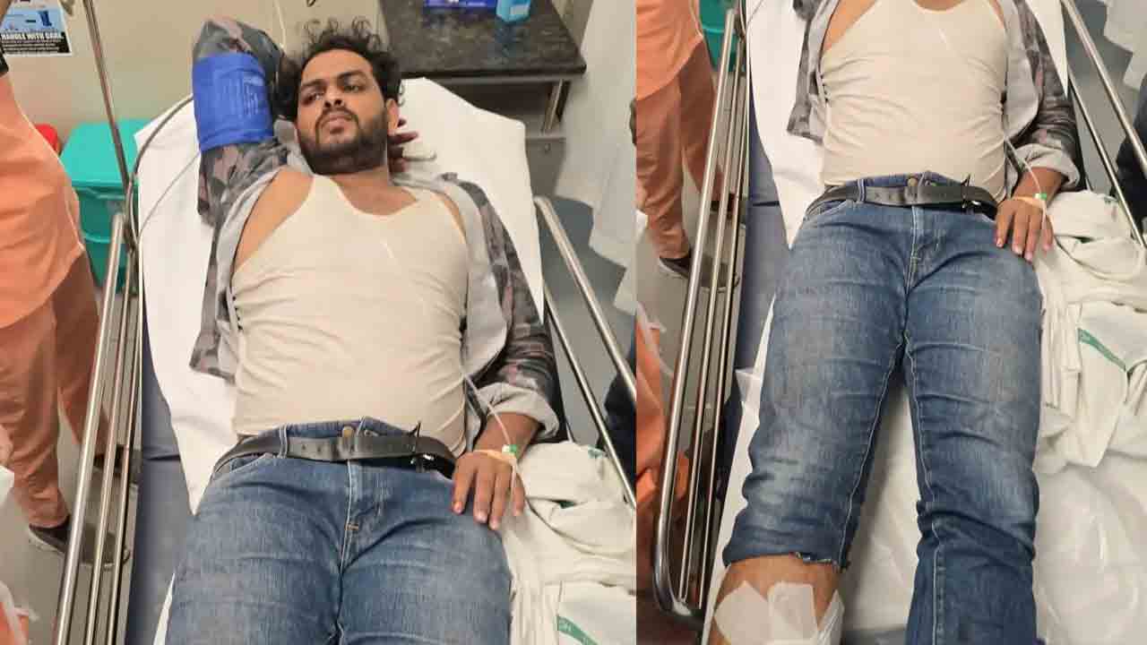 Firing | నగరంలో కాల్పుల కలకలం.. తుపాకీతో కాల్పులు జరిపి రూ.6 లక్షలు చోరీ