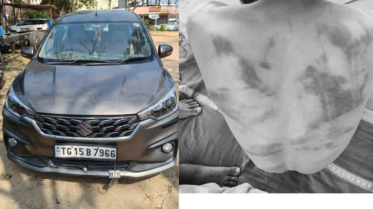 Lover Attack | కూతురితో ప్రియుడికి ఫోన్‌ చేయించి.. నర్సాపూర్‌ బస్టాండ్‌కు పిలిపించి..