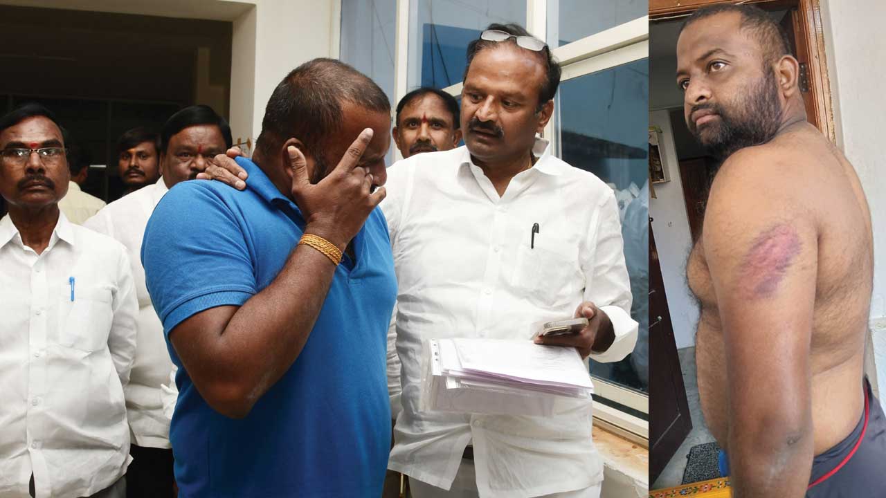 కాంగ్రెస్‌ నేతల గూండాయిజం