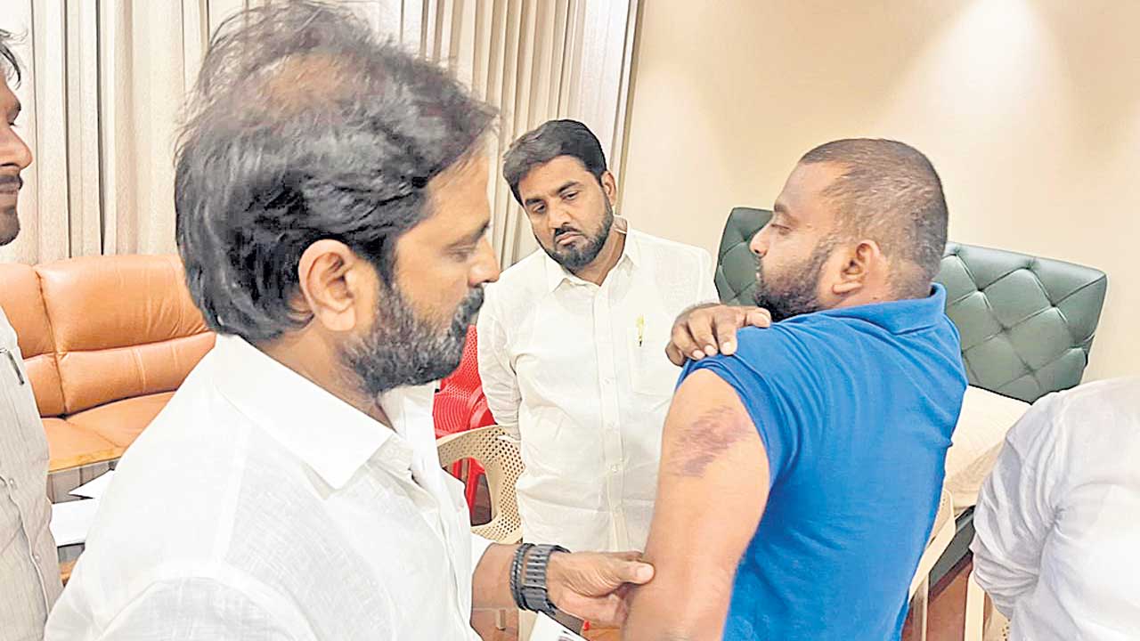 ఎన్నికల్లో ఓడితే కక్ష తీర్చుకుంటారా?