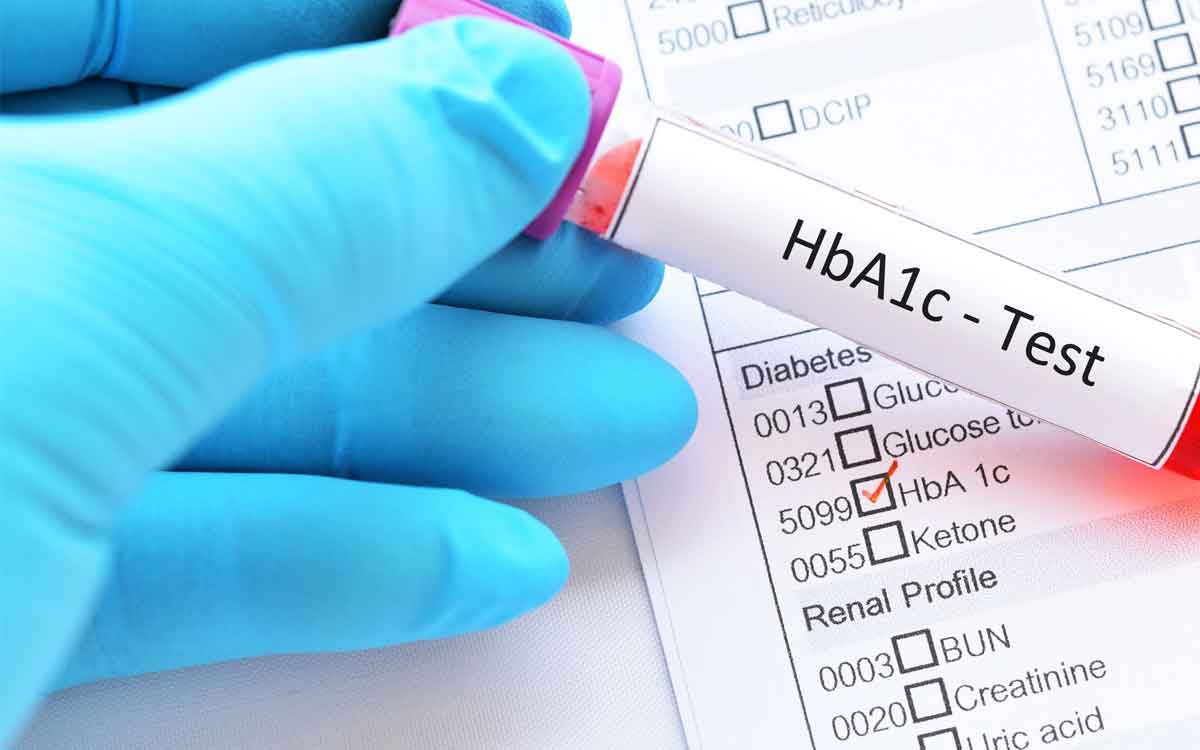 HbA1c | హెచ్‌బీఎ1సీ ప‌రీక్ష అంటే ఏమిటి..? దీన్ని అస‌లు ఎవ‌రు చేయించుకోవాలి..?