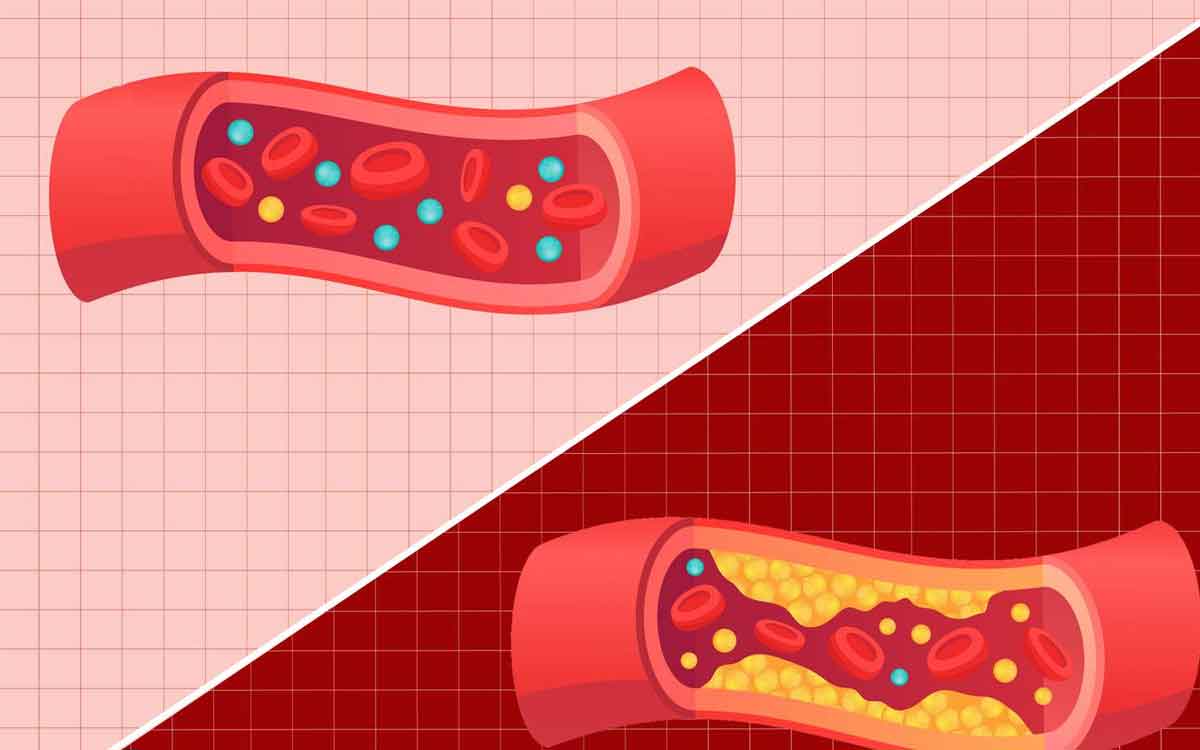 HDL And LDL | హెచ్‌డీఎల్, ఎల్‌డీఎల్ అంటే ఏమిటి..? మ‌న శ‌రీరంలో హెచ్‌డీఎల్ అస‌లు ఎంత ఉండాలి..?