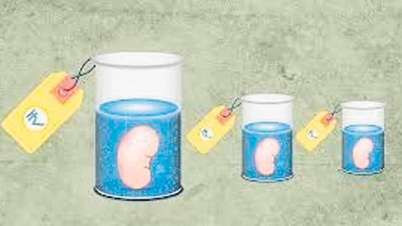 అంతర్జాతీయ కిడ్నీ రాకెట్‌ గుట్టురట్టు