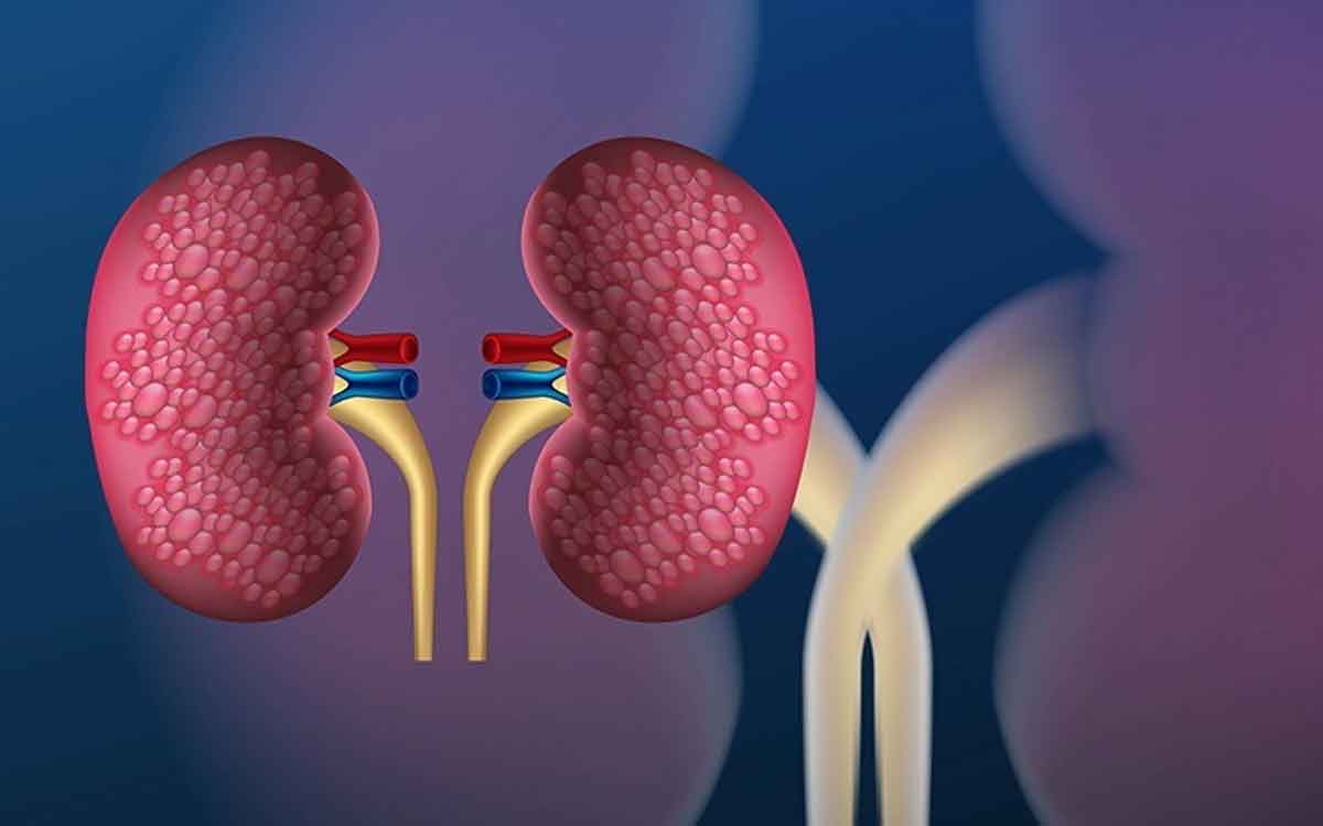 Kidney Diseases | ఈ ల‌క్ష‌ణాల‌ను ముందుగానే గుర్తిస్తే కిడ్నీ వ్యాధులు తీవ్ర‌త‌రం కాకుండా అడ్డుకోవ‌చ్చు..!