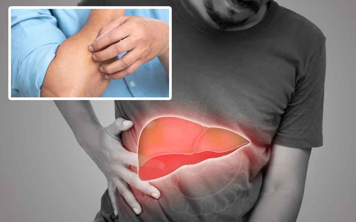 Liver Diseases Effect On Skin | మీకు లివ‌ర్ వ్యాధులు ఉంటే చ‌ర్మం ఈ ల‌క్ష‌ణాల‌ను తెలియజేస్తుంది..!