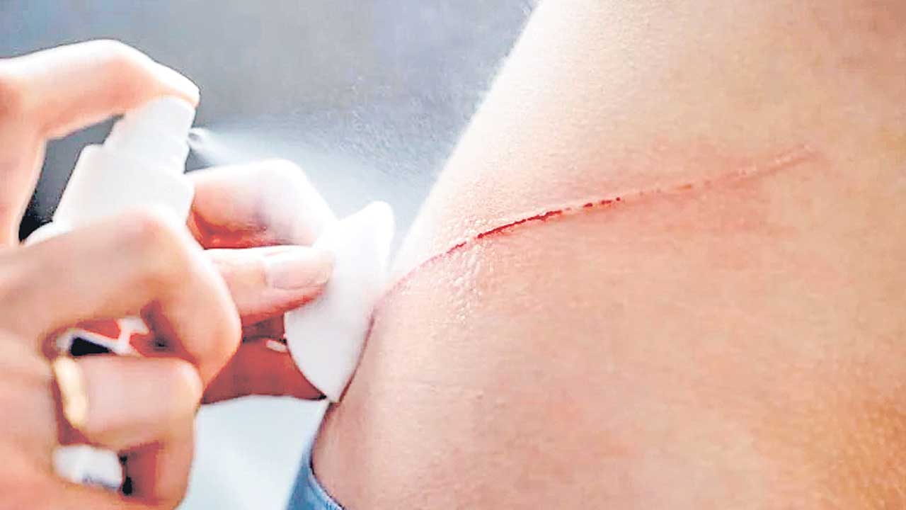 రక్త స్రావాన్ని క్షణంలో ఆపేసే పొడి!