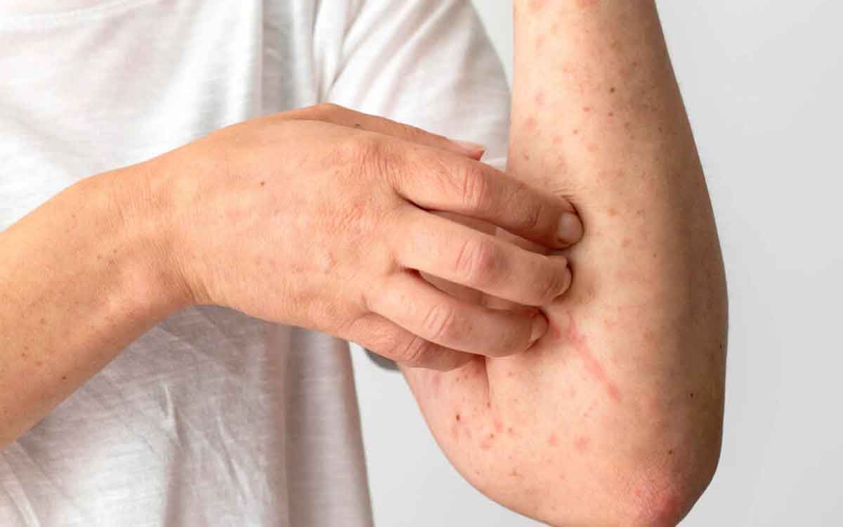 Liver Diseases | ఈ ల‌క్ష‌ణాలు మీలో క‌నిపిస్తుంటే.. మీకు లివ‌ర్ వ్యాధులు ఉన్నాయ‌ని గుర్తించాలి..!