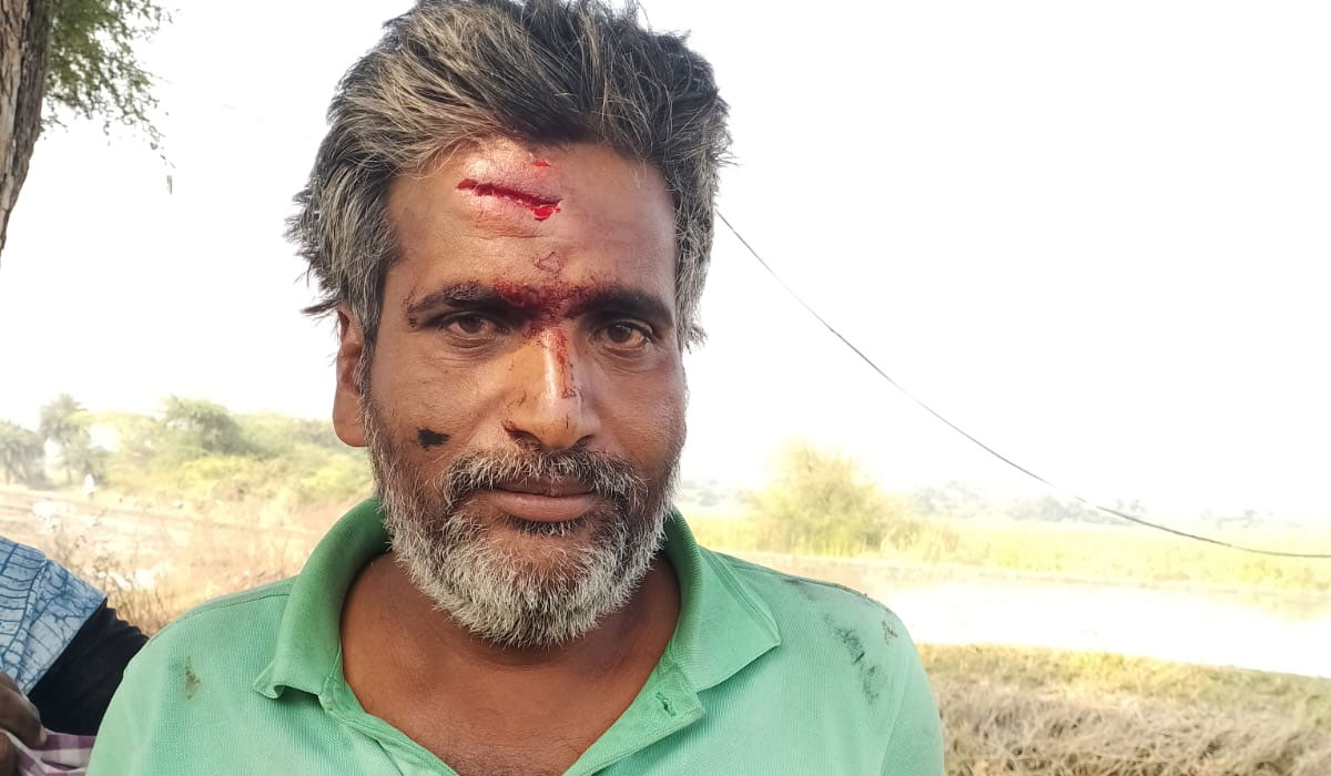 Singapur | ప్రమాదవశాత్తు తాటి చెట్టు పై నుంచి జారీ పడి గీత కార్మికుడికి గాయాలు