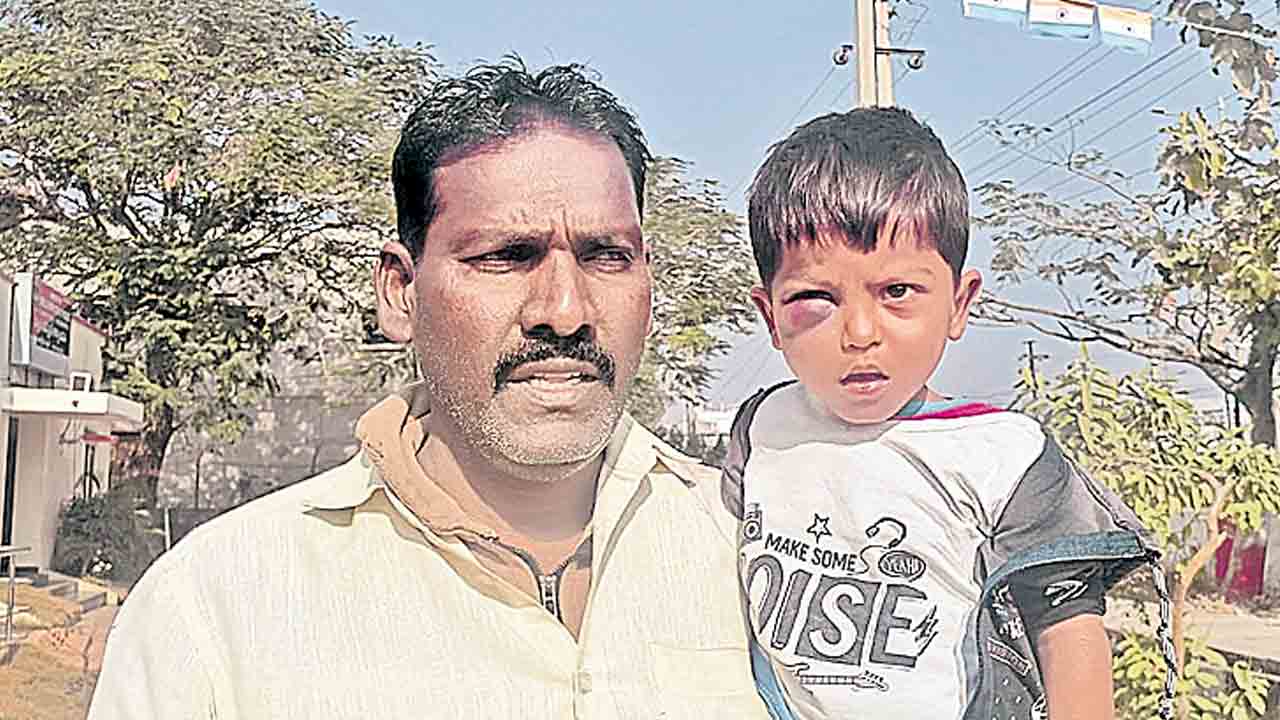 బాలుడిని చితకబాదిన అంగన్‌వాడీ టీచర్‌!