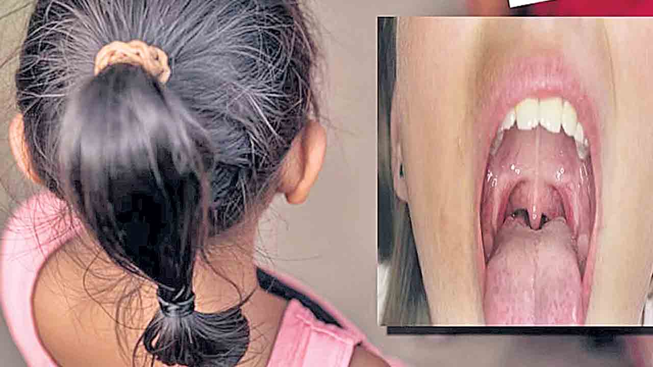 రెండున్నర ఏండ్లుగా నోరు మూయలేక!